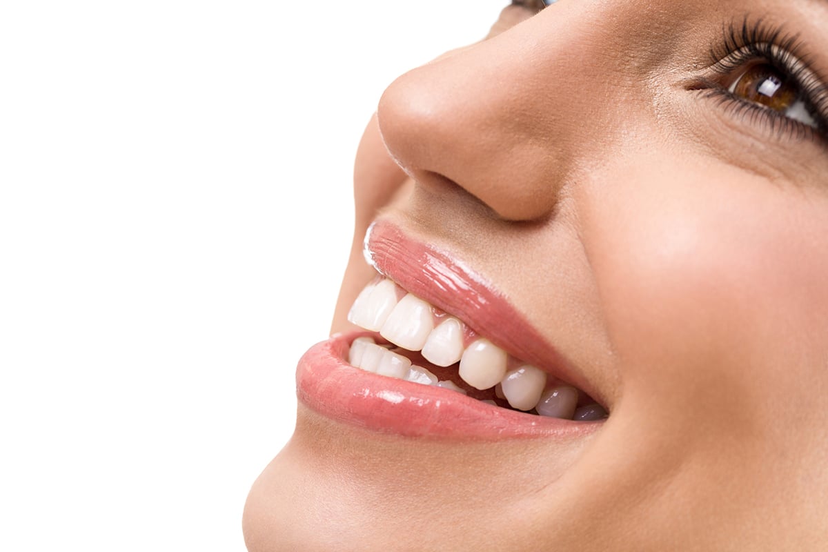 Cosmetic Bonding Vs Veneers Which Cosmetic Dentistry Option Fits Your Needs Blog